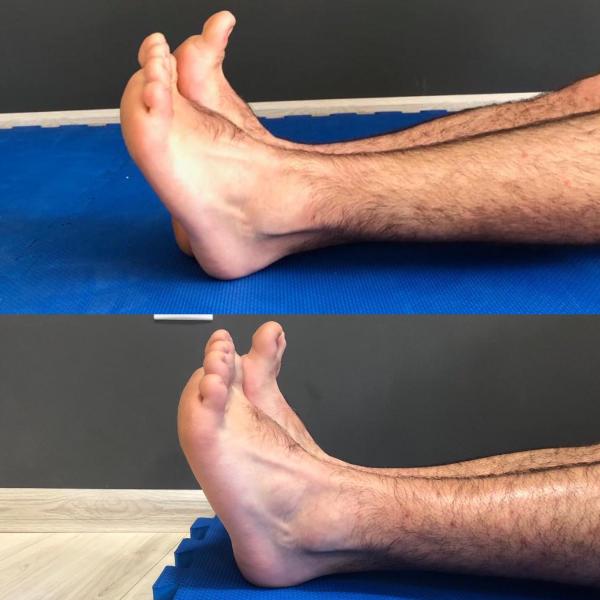 Afecțiuni ale gambei si tendonului Achilian